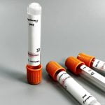 Disposable Medical Vacuum Blood Collection Tube Vials