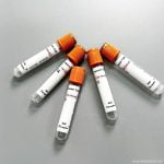 Medical Supplies Colorful Vacuum Blood Collection Tube Blood