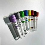 Blood sample collection tube vacuum blood collection vessel