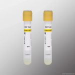Clinical hematology blood collection consumables