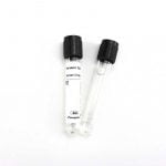 ESR test 3.8% sodium citrate vacuum blood collection