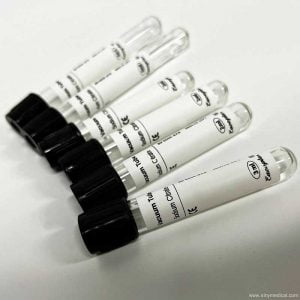 ESR test 3.8% sodium citrate vacuum blood collection