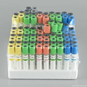 Sodium fluoride + EDTA K2 blood collection vessel