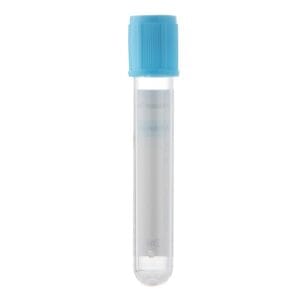 2ml 3.2% Sodium Citrate Tube with Gel