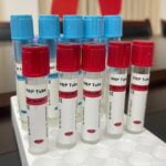 EDTA ha biotin sodium citrate PrP tube 1