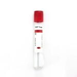 Medical Disposable Vacuum Blood Sample Vials Prp Tubes