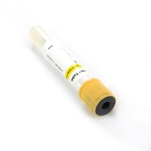 Medical Disposable Vacuum Blood Sample Vials Prp Tubes 5 768x768 1