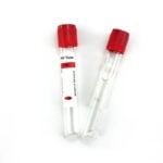 Medical-Disposable-Vacuum-Blood-Sample-Vials-Prp-Tubes