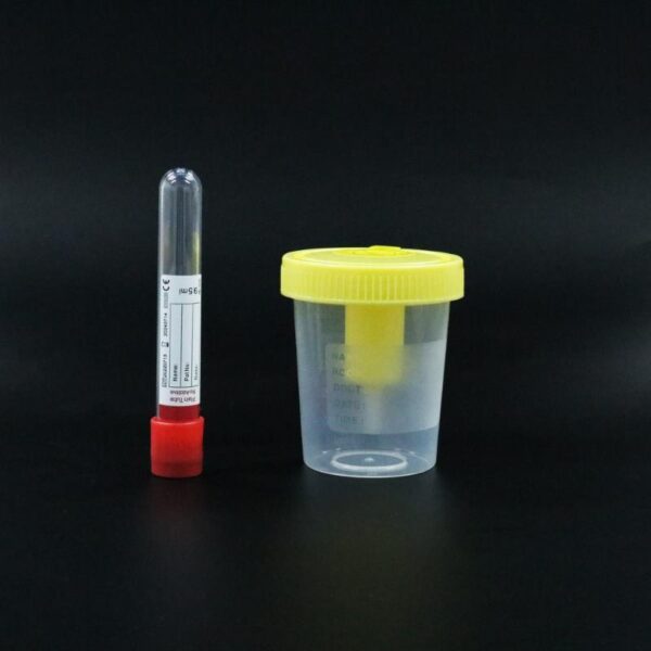 Medical Supplies Urine Sample Cup with collection tube 3 Product Image Size