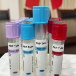 PRP tube for collecting plasma calcium chloride 5