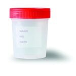 Siny Hospital Sterile Plastic Disposable Stool sample cup 1
