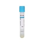 15ml PRP Tube for PRP Treament 1 768x768 1