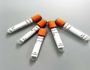 Blood Collection Tube 2