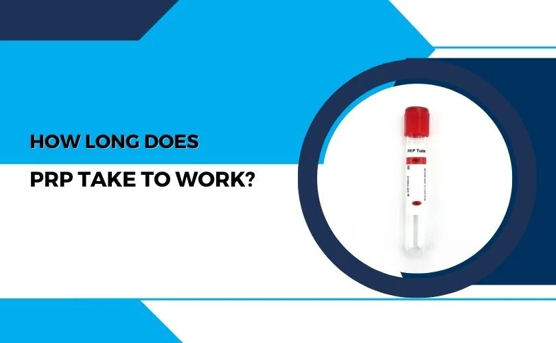 How Long Does PRP Take to Work