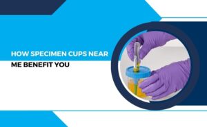 How Specimen Cups Near Me Benefit You