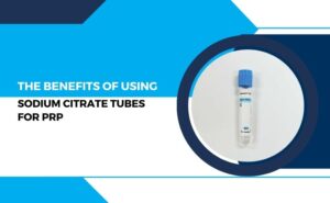 The Benefits of Using Sodium Citrate Tubes for PRP