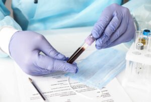 blood collection tubes manufacturer supplier