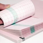 Siny Medical ECG Paper