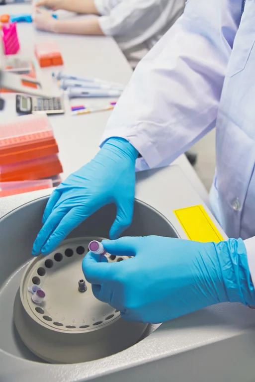 Production Process Blood Collection Tube