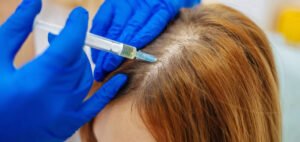 Siny Medical PRP Therapy