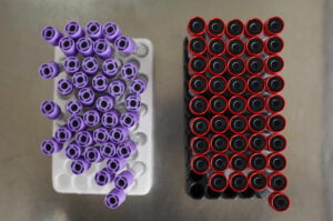 Sinymedical serum tubes