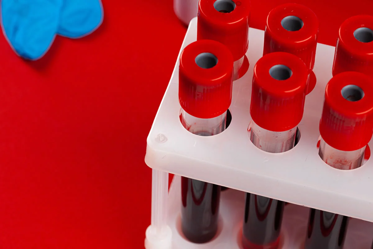 We are a Leading Manufacturer of Blood Collection Tube