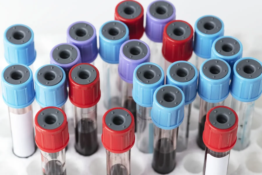 We are a Leading Manufacturer of Serum Blood Collection Tube