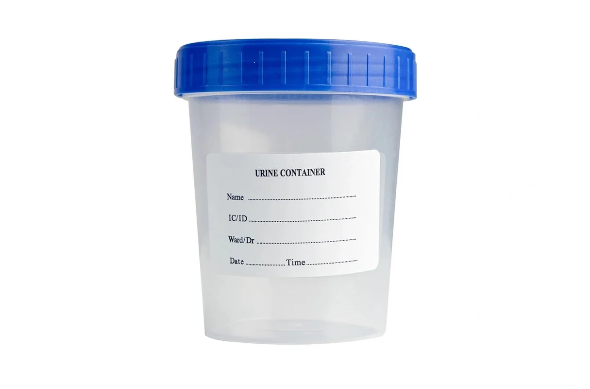 A Urine Cup is a Container for Collecting Urine Samples
