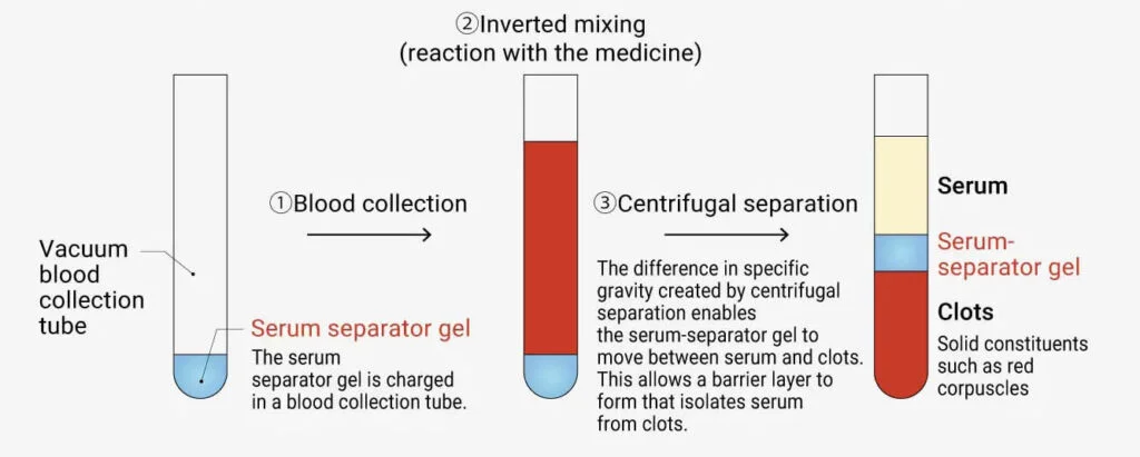 What is a Separation Gel Serum Tube