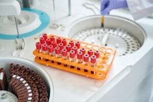Rack of blood tubes with barcode labels with centrifuge on the background
