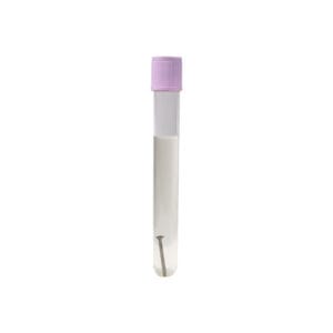 Sulfate Reducing Bacteria Test Tube