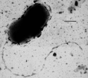 What Are Sulfate Reducing Bacteria?