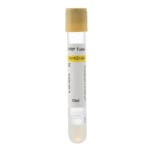 Siny Medical Platelet Rich Plasma ACD+GEL+HA PRP Tubes