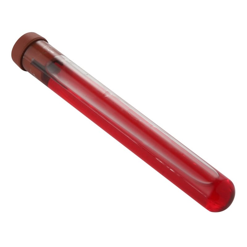 What Is a Total General Bacteria Detection Tube?