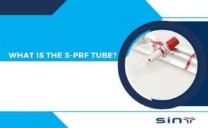 What Is the S PRF Tube?