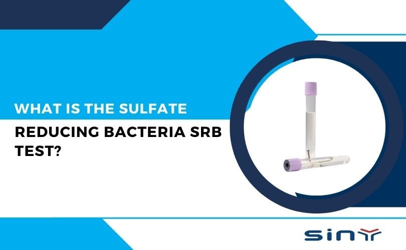 What is the Sulfate Reducing Bacteria SRB Test?