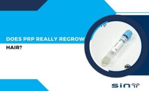Does PRP Really Regrow Hair?