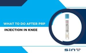 What to Do After PRP Injection in Knee