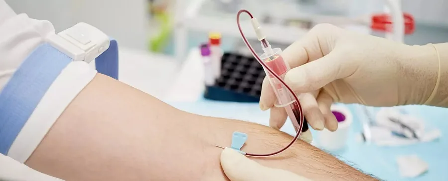 plasma separator  Tubes work