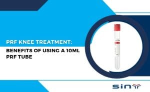 PRF Knee Treatment: Benefits of Using a 10ml PRF Tube
