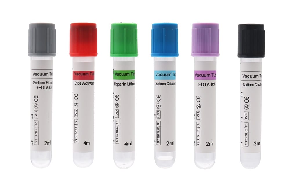 Siny Medical Vacuum Tube Blood Collection Set