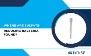 Where Are Sulfate Reducing Bacteria Found?