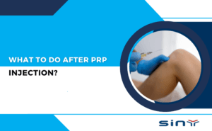 What to Do After PRP Injection?