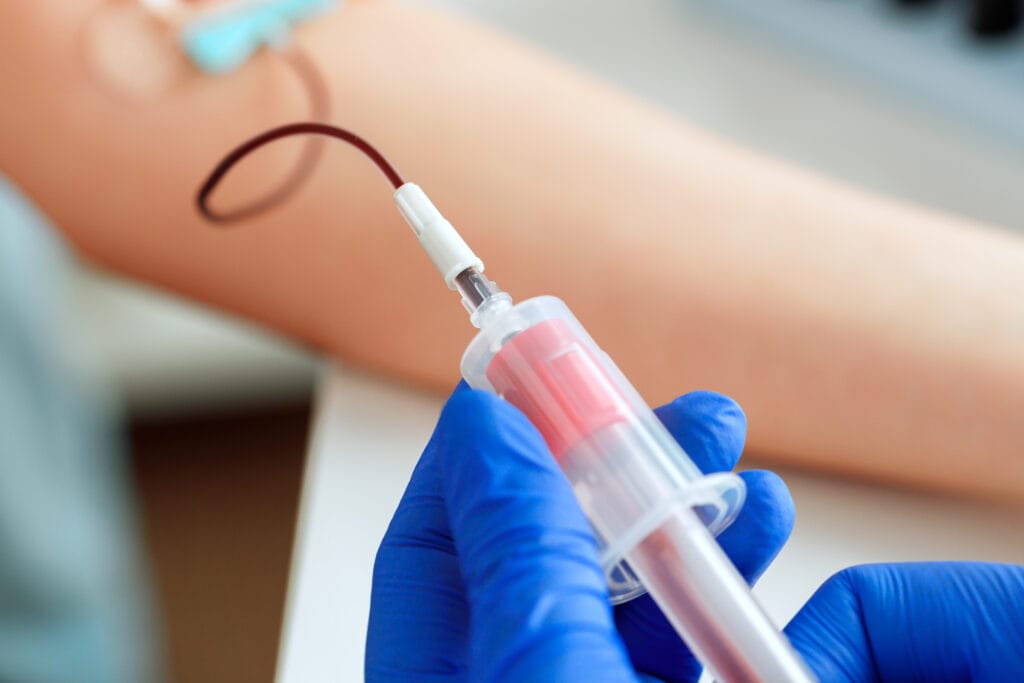 Hands of a doctor taking blood samples using a tube holder