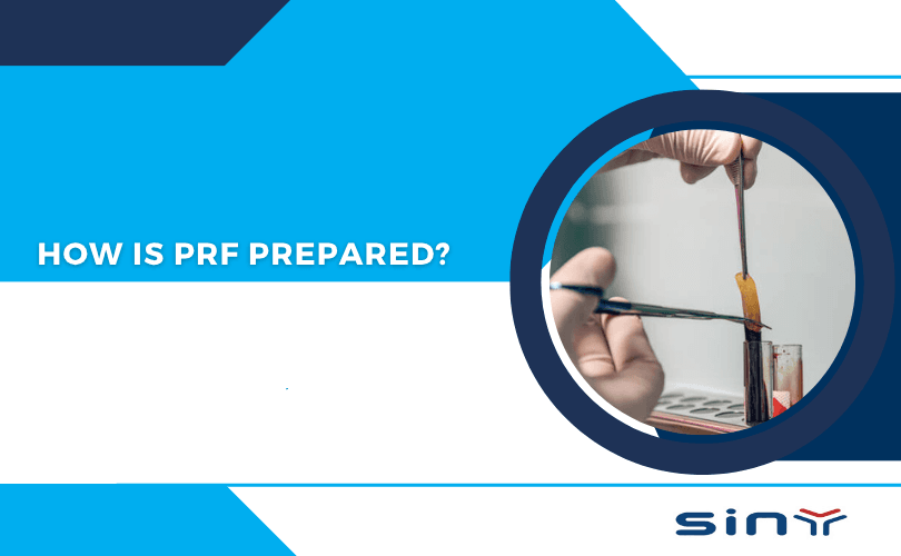 How Is PRF Prepared?