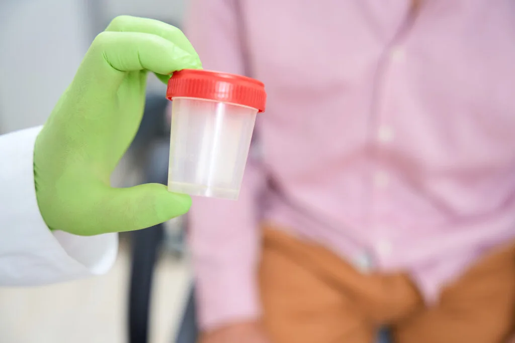 Urinalysis