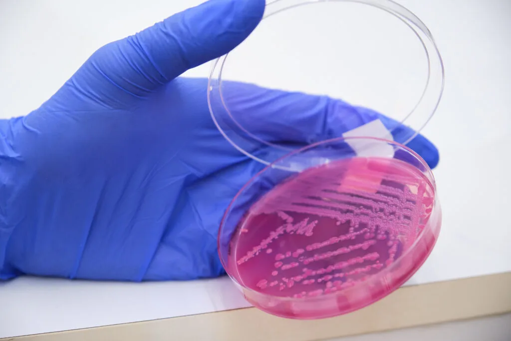 Scientific hand with glove holding bacterial cultures in a pink Petri dish.