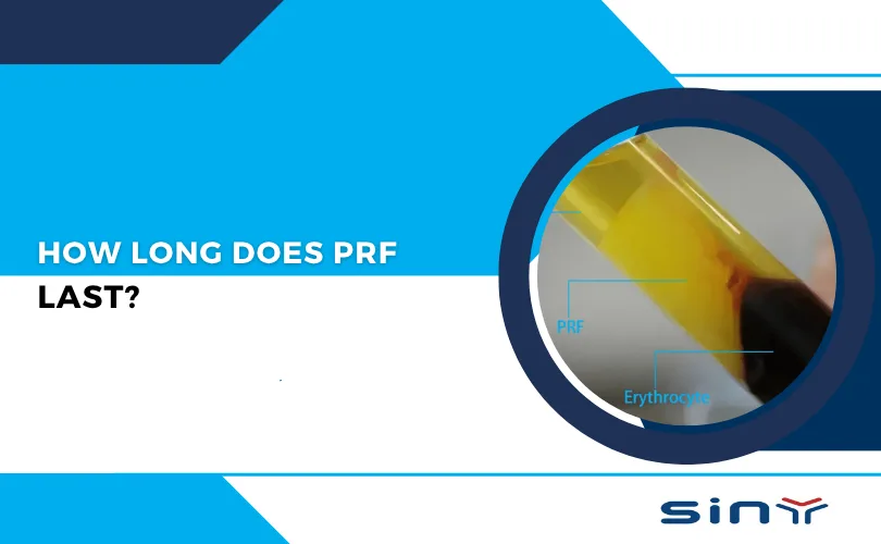 How Long Does PRF Last?