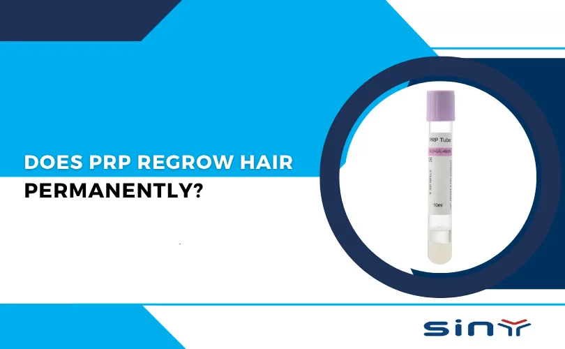 Does PRP Regrow Hair Permanently