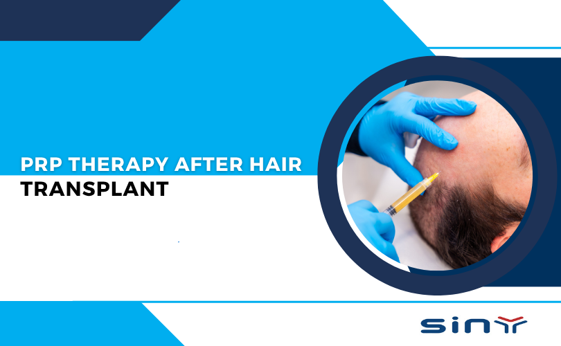 PRP Therapy After Hair Transplant